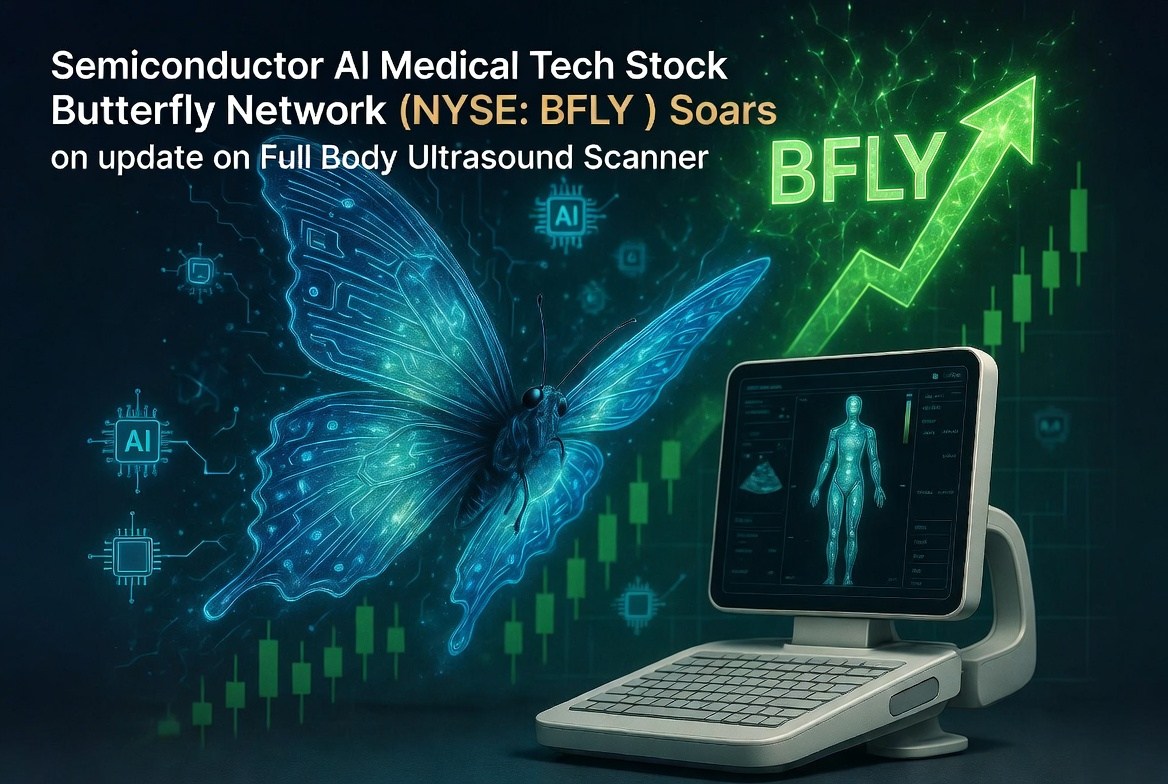BFLY Surges 33% on Midjourney Full-Body Scanner Deal